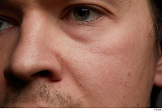 HD Skin Brandon Davis cheek eye face head mustache nose…